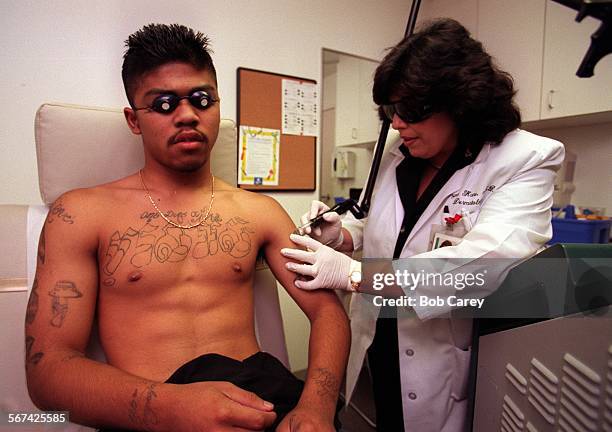 Tattoo.1.0819.BC.D Former gang member Mason Phom wears protective glasses as Dr.Bryna Kane uses laser to remove a gang tattoo from Phom's shoulder...
