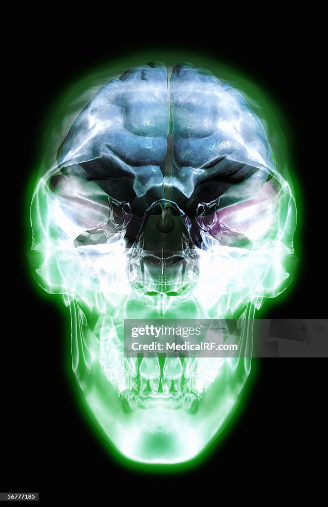 Anterior view of an x-ray skull with an overlay of the internal anatomy of the brain.