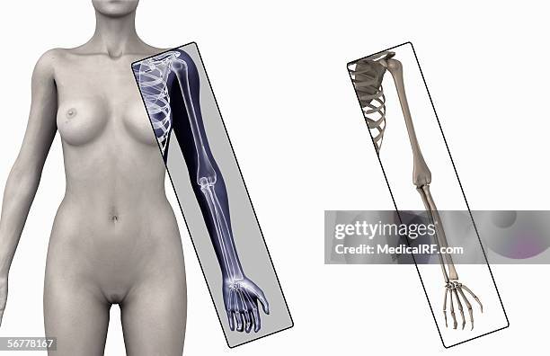 anterior illustration of the bones of the arm. - metacarpal stock illustrations