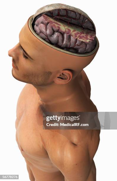 lateral view of the human brain, within a sectioned head and skull. - pons brain stock illustrations