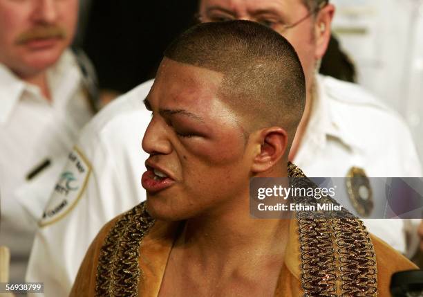 The left eye of Fernando Vargas swells up after losing to Shane Mosley at the junior middleweight fight at the Mandalay Bay Events Center on February...