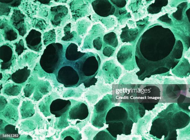 alveoli in the lung - electron micrograph stock pictures, royalty-free photos & images