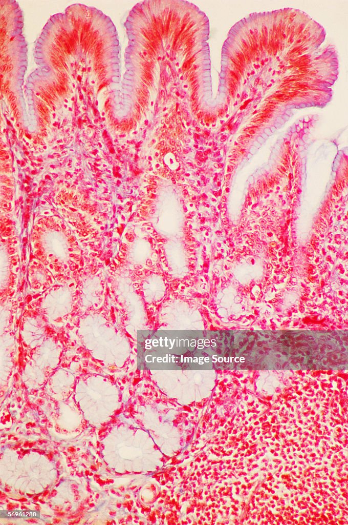 Pyloric region of stomach