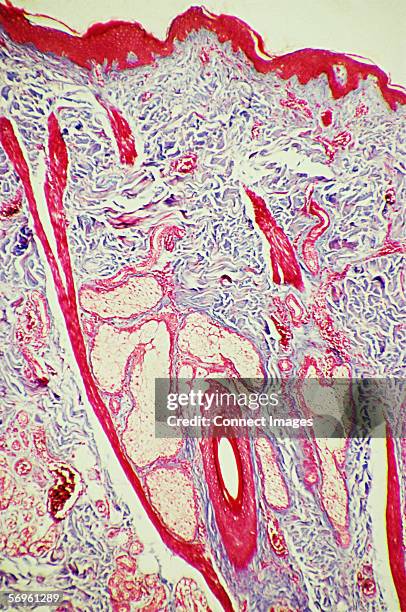 hair follicle in skin - sebaceous gland stock pictures, royalty-free photos & images