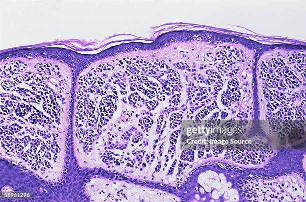 haut weg - biological cell stock-fotos und bilder