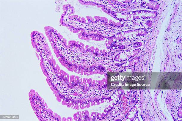 jejunal mucosa - small intestine stock pictures, royalty-free photos & images