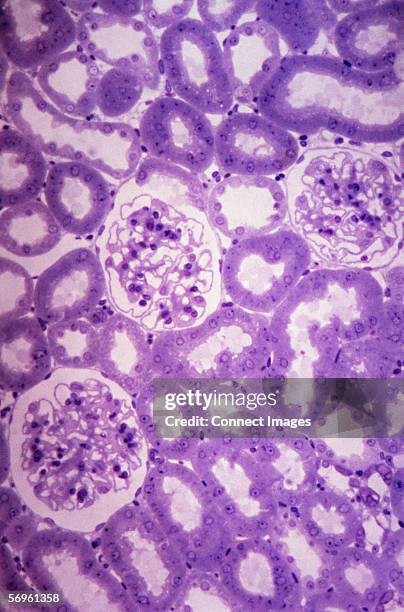 glomeruli and tubules in kidney - tubule stock pictures, royalty-free photos & images