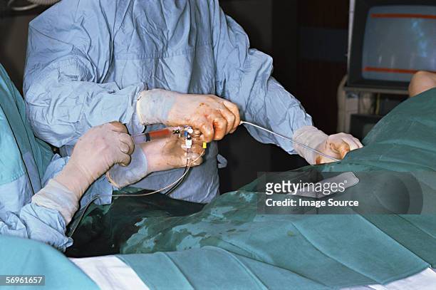 heart surgery - catheter stock pictures, royalty-free photos & images