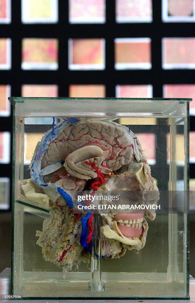 An anatomical piece consisting in a huma