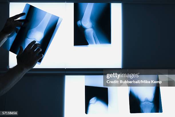 person's hand positioning an x-ray - light box stock-fotos und bilder