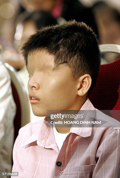 Vietnam's 14 years old alleged Agent Orange victim Le Van O, from Southern province of Kien Giang attends an international conference on the effects...