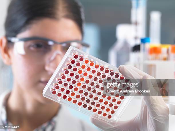 close up of female scientist examining micro plate blood samples in laboratory - ematologia foto e immagini stock