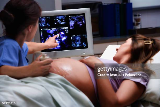 pregnant woman receiving ultra sound with female doctor - ultrasound stockfoto's en -beelden