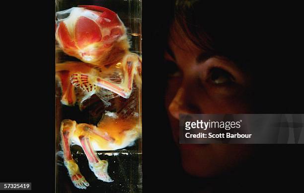 Woman examines an exhibit of a 20 week old foetal bone development during the Bodies.....The Exhibition on April 12, 2006 in London, England. The...