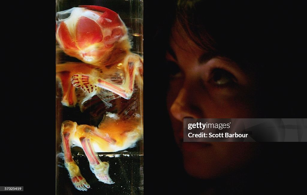Bodies Exhibition Opens In London