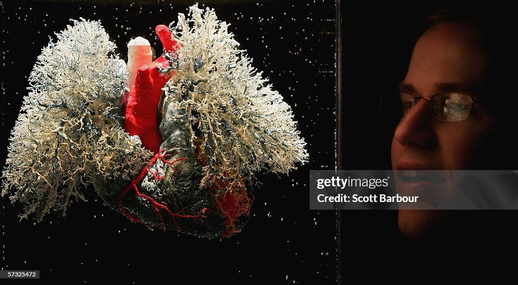 Bodies Exhibition Opens In London