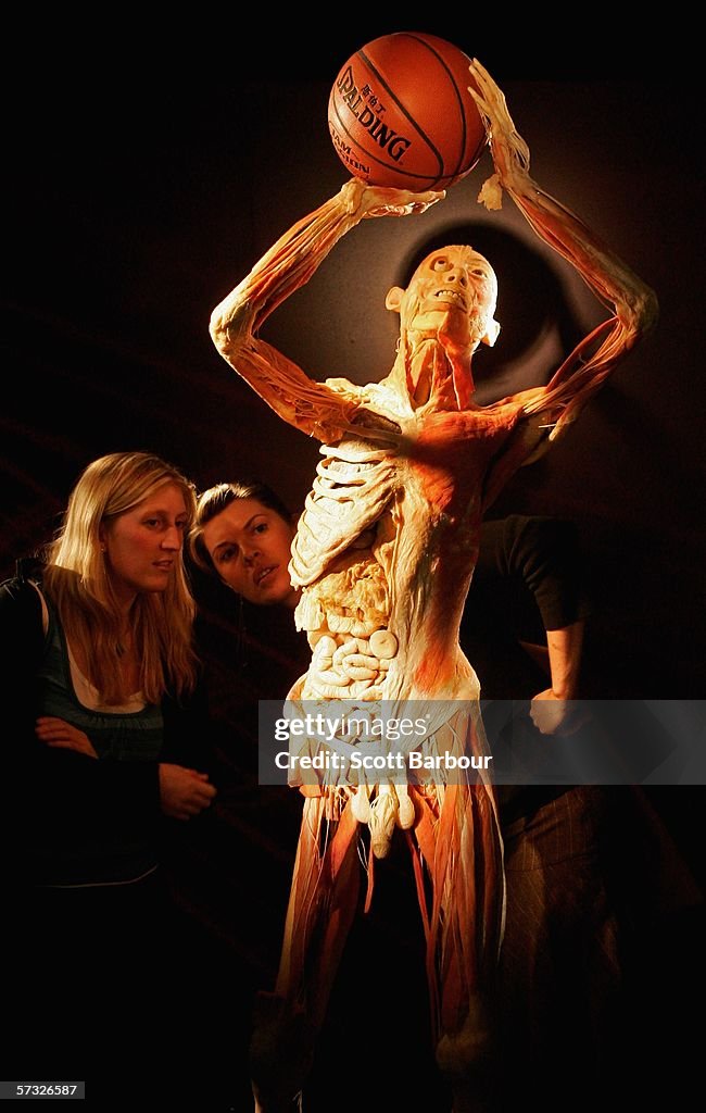 Bodies Exhibition Opens In London