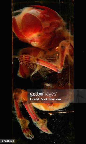 An exhibit of a 20 week old foetal bone development sits on display during the Bodies.....The Exhibition on April 12, 2006 in London, England. The...
