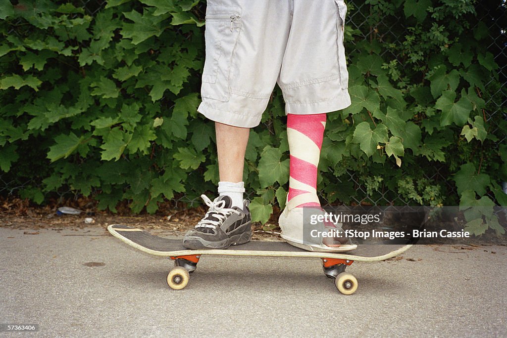 Young man with leg in plaster standing on skateboard