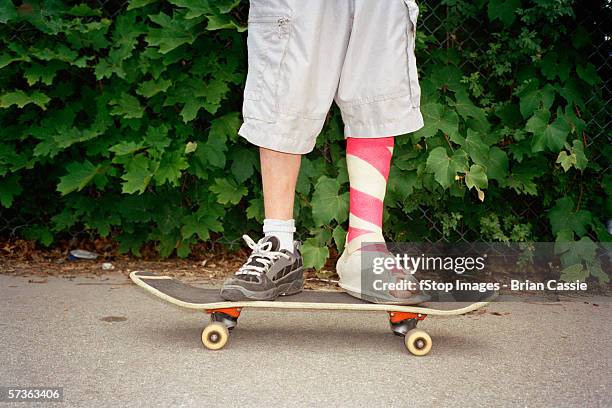 young man with leg in plaster standing on skateboard - miss f stock pictures, royalty-free photos & images