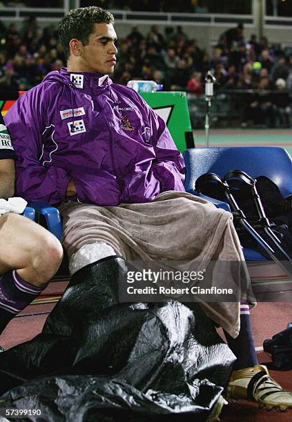 Greg Inglis of the Storm looks on from the bench after he was injured during the round seven NRL match between the Melbourne Storm and the Newcastle...
