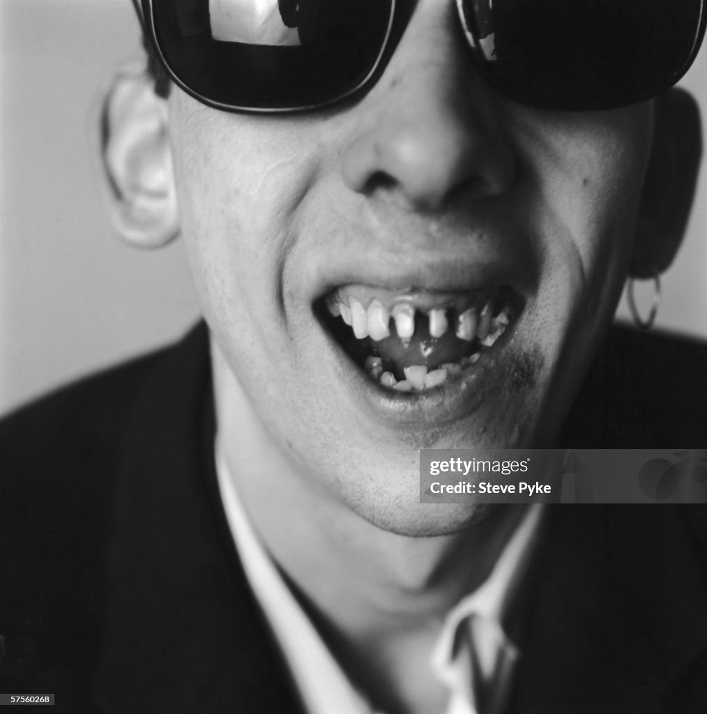 Shane MacGowan