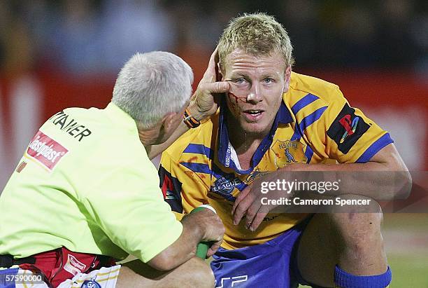 Luke Lewis of City is treated for a cut to his face during the NRL City v Country Origin match at Apex Oval May 12, 2006 in Dubbo, Australia.