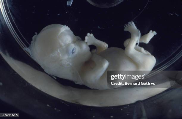 1 007 Human Embryo Development Stages Stock Photos High Res Pictures 1-007-human-embryo-development-stages-stock-photos-high-res-pictures