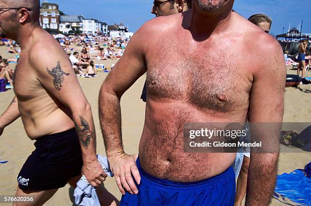 sunburned man at the beach - sunburnt stock pictures, royalty-free photos & images