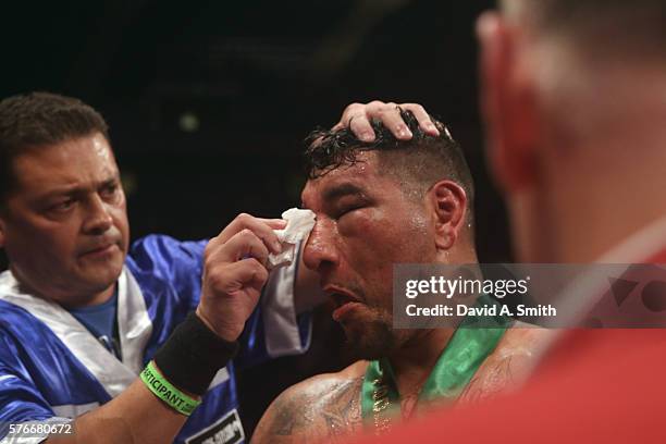 Chris Arreola receives treatment after his loss to WBC World Heavyweight Champion Deontay Wilder at Legacy Arena at the BJCC on July 16, 2016 in...