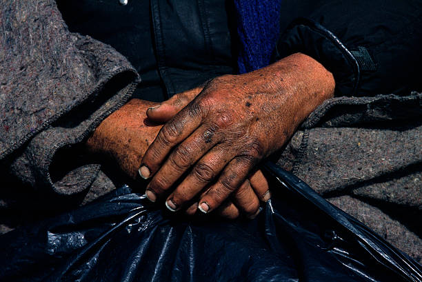 Middle-Aged Homeless Woman's Hands