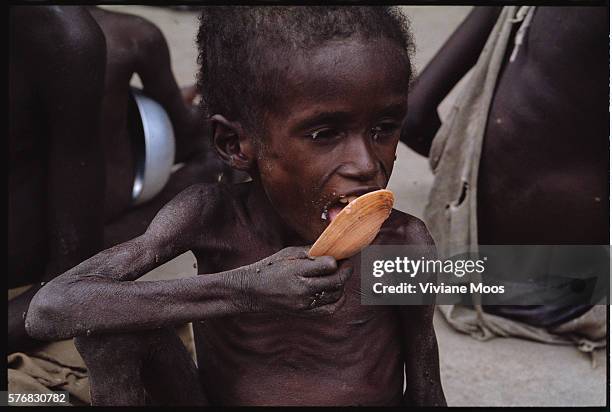 An emaciated boy eats his ration of porridge at a feeding center in Kongor, Sudan. Civil war and widespread famine have ravaged Sudan for decades,...