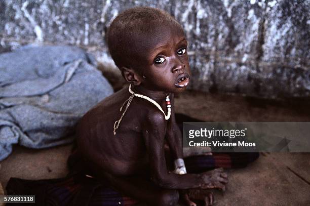 An emaciated child awaits a meal at a feeding center in Kongor, Sudan. Civil war and widespread famine have ravaged Sudan for decades, resulting in...