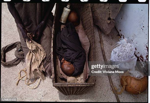 Malnourished infant in Kongor, Sudan, lies sleeping in a cradle as his mother kneels at his side. Civil war and widespread famine have ravaged Sudan...