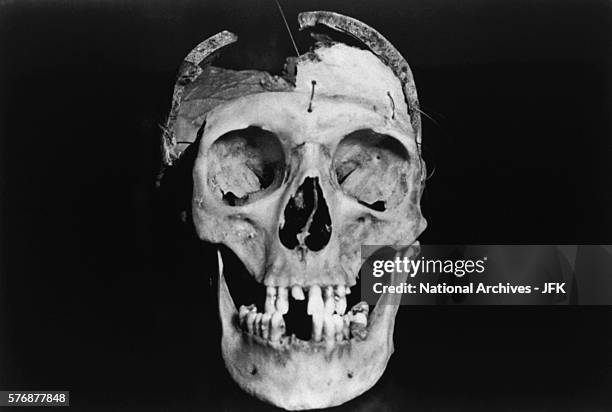 Model skull shows where a bullet impacted the head of President John Fitzgerald Kennedy. This skull was submitted as evidence to the Warren...