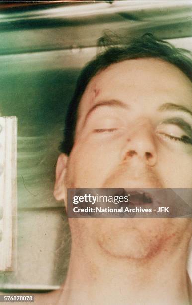 Lee Harvey Oswald post-autopsy viewed through body bag.