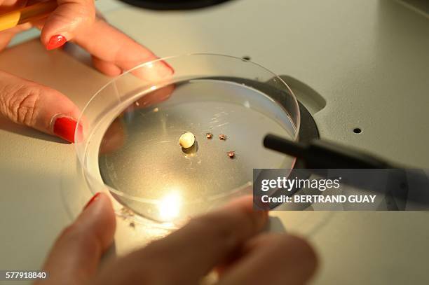 Scientist studies ticks, whose bite can transmit the Lyme disease, at the French National Institute of Agricultural Research in Maison-Alfort, on...