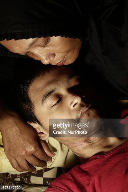 Jakarta, Indonesia, 20 July 2016 : REZA JIVAN DARMAWAN son of mother Mrs. SITI CHODIJAH diagnose with Lamfa Dimita TB and Kelloid Maligna rest at...