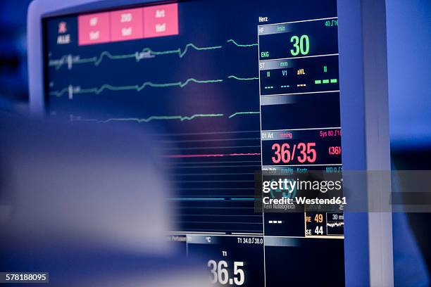 patient monitor - heartbeat foto e immagini stock