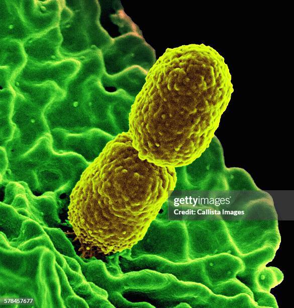 colorized sem of two rod-shaped carbapenem-resistant klebsiella pneumoniae (crkp) bacteria (yellow) interacting with a human neutrophil white blood cell (green) - antibiotikaresistent stock-fotos und bilder