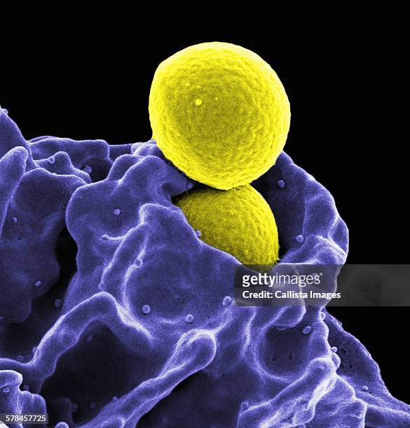 colorized sem of two spherical methicillin-resistant staphylococcus aureus (mrsa) bacteria (yellow) in the process of being phagocytized by a human neutrophil white blood cell (blue) - estafilococo fotografías e imágenes de stock