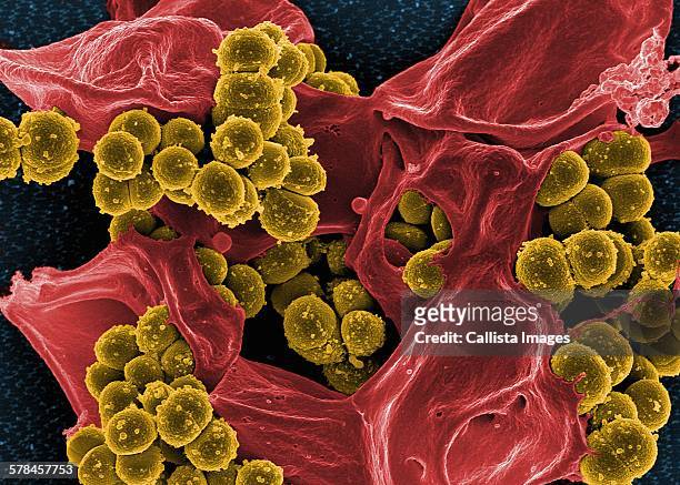 colorized sem of methicillin-resistant staphylococcus aureus (mrsa) bacteria in the process of being phagocytized by a human neutrophil white blood cell - estafilococo fotografías e imágenes de stock