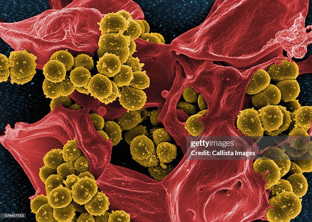 Colorized SEM of methicillin-resistant Staphylococcus aureus (MRSA) bacteria in the process of being phagocytized by a human neutrophil white blood cell