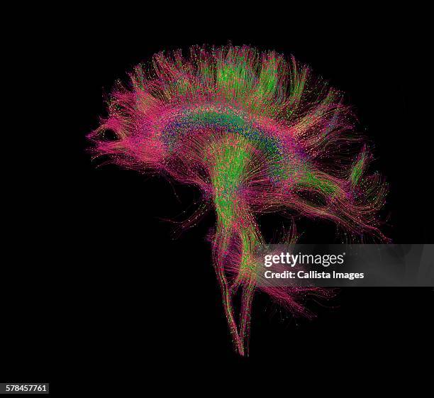 diffusion mri, also referred to as diffusion tensor imaging or dti, of the human brain - human brain mri stock pictures, royalty-free photos & images