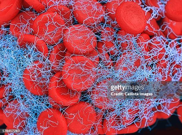 ilustraciones, imágenes clip art, dibujos animados e iconos de stock de illustration of a blood clot showing a clump of red blood cells intertwined in a fibrin mesh - fibrin