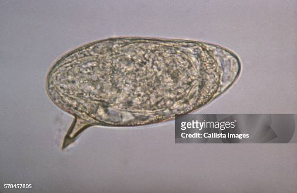 schistosoma mansoni egg showing lateral spine. schistosomiasis (also known as bilharzia, snail fever, and katayama fever) is a disease caused by parasitic worms of the schistosoma type - schistosoma stock pictures, royalty-free photos & images