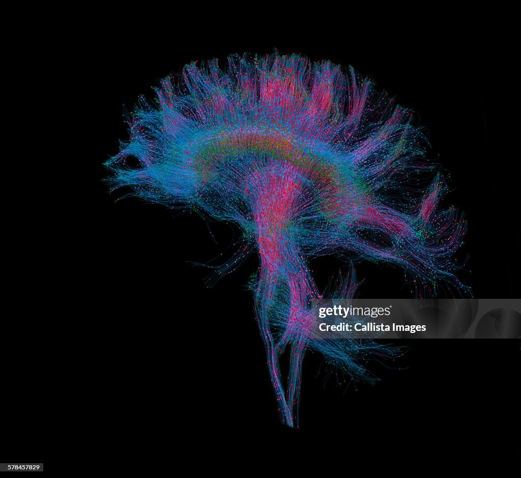 Diffusion MRI, also referred to as diffusion tensor imaging or DTI, of the human brain