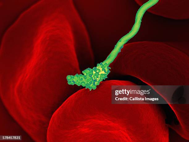 colorized sem of a spiral-shaped borrelia hermsii bacterium (green) on a number of red-colored red blood cells. b. hermsii is the causative agent of tick-borne relapsing fever (tbrf) - spiral bacterium stock pictures, royalty-free photos & images