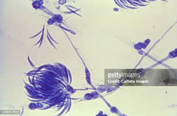 lactophenol cotton blue-stained fusarium fungal organism - micro organism stock-fotos und bilder