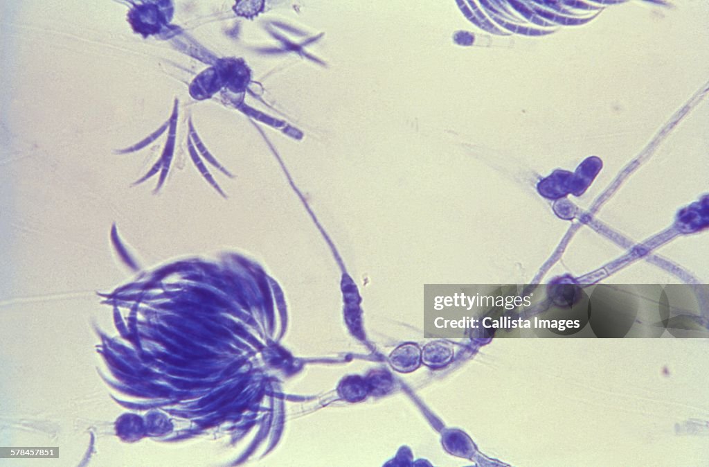 Lactophenol cotton blue-stained Fusarium fungal organism